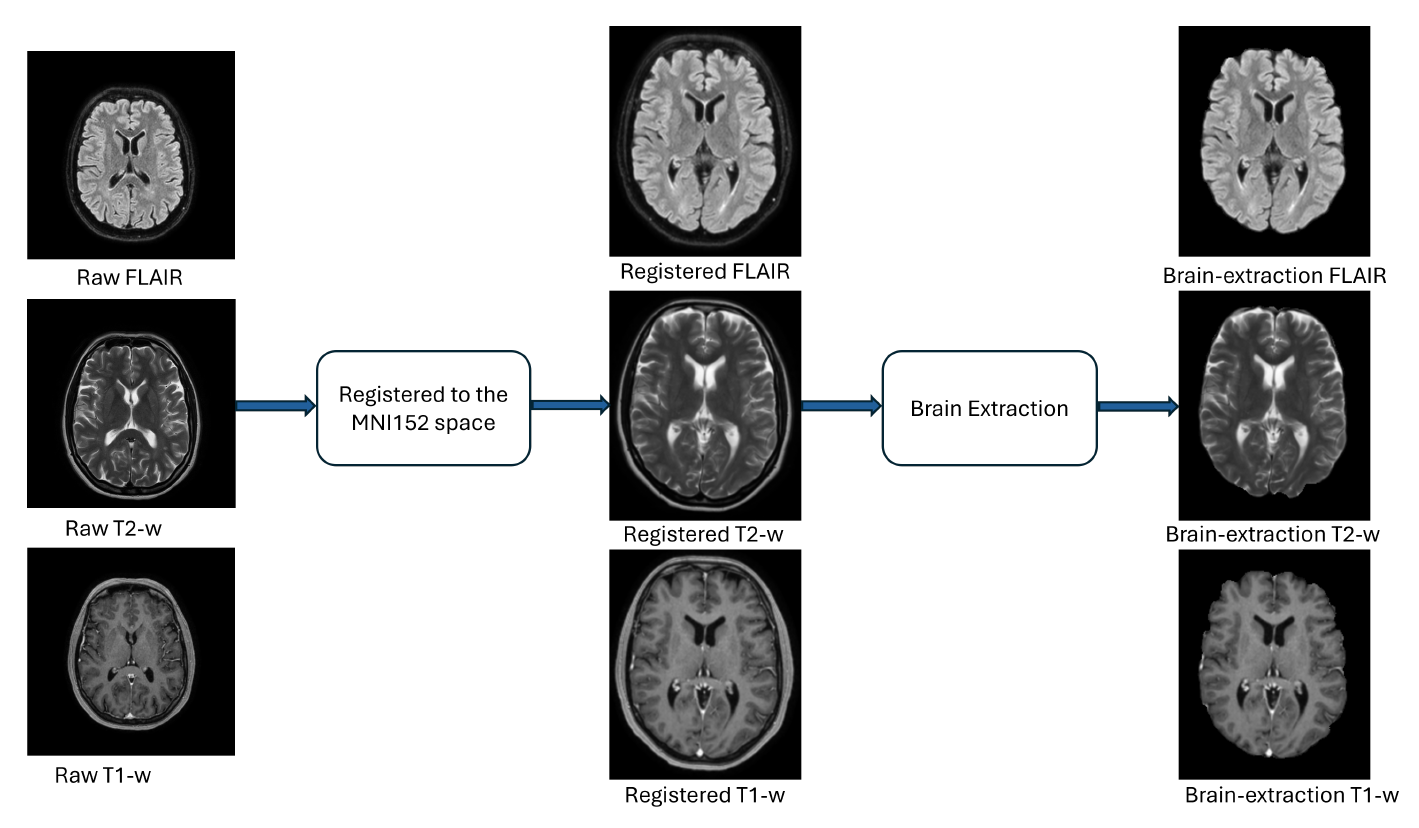 ICPR 2024 competition visual on multiple sclerosis lesion segmentation
