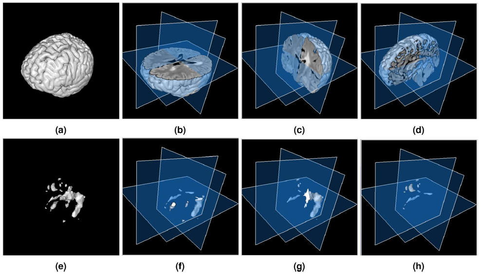 MSLesSeg dataset overview