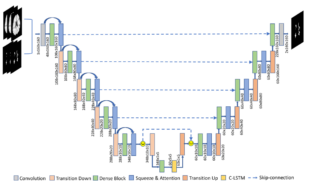 Attention mechanism for multiple sclerosis lesion segmentation